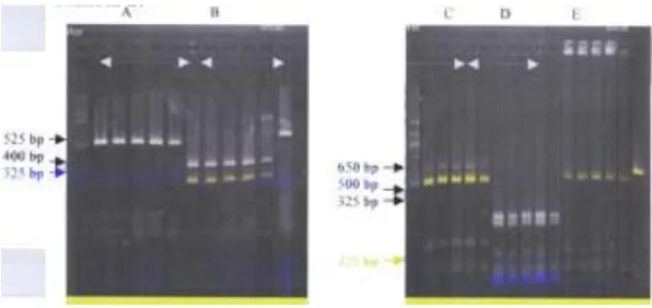 Gambar 3. Pola pita dari hasil pemotongan mt-DNA dengan menggunakan 5 enzim restriksi (A)