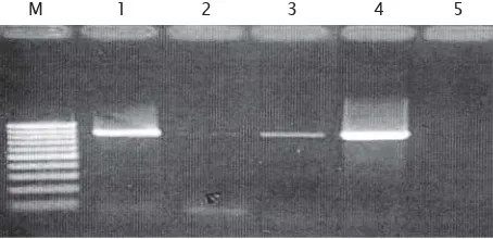 Gambar 2. Hasil ekstraksi DNA S. iniae dengan 3 macam metode. M. Marker; Lane 1. Metode