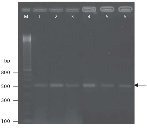 Gambar 1. Fragmen tunggal gen anti virus PmAV yang diisolasi dari DNA komplementer