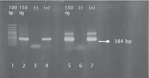 Gambar 1. Nested Figure 1.PCR timidine kinase pada amplicon 384 bp. Lane 1: DNA Ladder 100 bp; Lane2: DNA KHV step-1 timidine kinase; Lane 3: kontrol negatif; Lane 4: kontrol positif;Lane 5: nested timidine kinase; Lane 6: kontrol negatif; lane 7: kontrol 