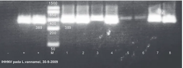 Gambar 4. Profil amplifikasi PCR sampel udang L. vannamei yang terinfeksi IHHNV pada targetberat molekul 389 bp