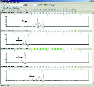 Gambar 2. Hasil separasi PCR produk ikan kerapu sunu, P. leopar dus dengan primer PL- 08menggunakan ABI 3100 Aviant Genetic Analyzer (A
