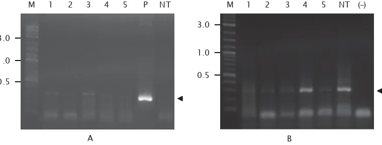 Gambar 3. Ekspresi mRNA PhGH eksogen pada sirip individu ikan patin siam transgenik (A) danmRNA β-aktin ikan patin siam (B) sebagai kontrol internal
