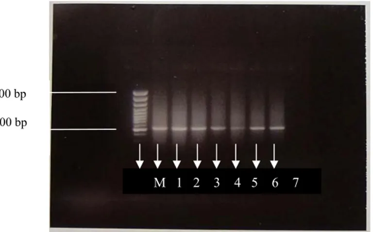 Gambar 2. Hasil elektroforesis produk PCR dengan primer Phc1 dan Phc2 