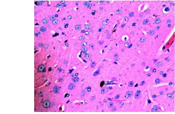 Gambar 4. Hasil pengamatan organ otak mencit dengan pewarnaan HE, 