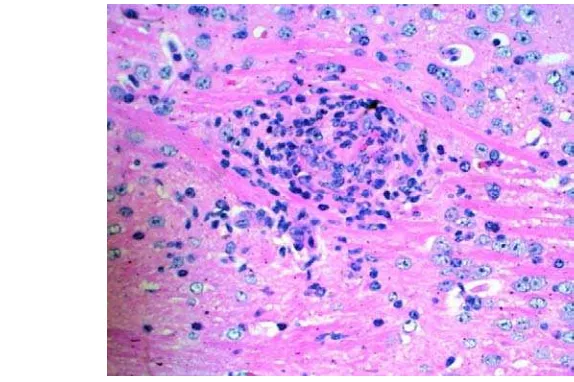 Gambar 5. Histopatologi otak mencit dengan pewarnaan HE, perbesaran objektif                   40x