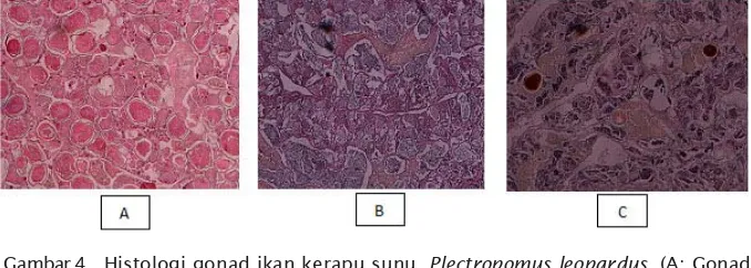 Gambar 4. Histologi gonad ikan kerapu sunu, Plectropomus leopardus. (A; Gonad