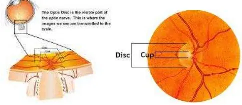 Fig. 1. Optic disc and optic cup 