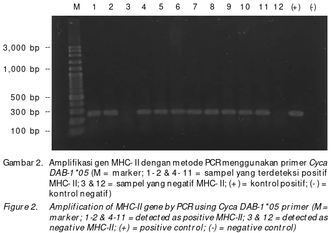 Gambar 2. Amplifikasi gen MHC- II dengan metode PCR menggunakan primer Cyca