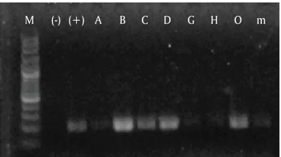 Gambar 1. Hasil analisis PCR bakteri Streptococcus agalactiaeFigure1.PCR analysis result of Streptococcus agalactiae bacteria