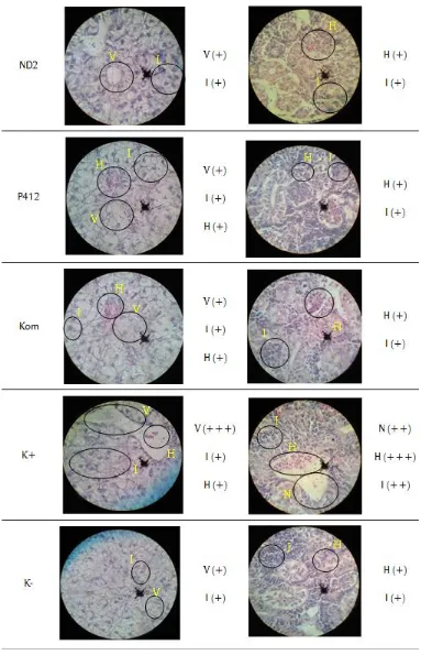 Gambar 2.Histopatologi hati dan ginjal ikan lele dumbo (Clarias gariepinus) pada perlakuan