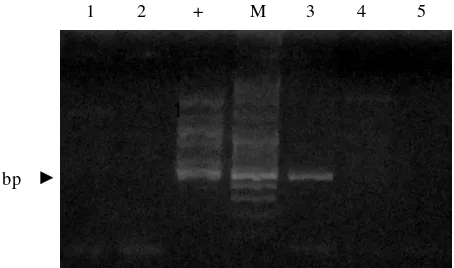 Gambar 2.Deteksi transgen (krt-GP11) pada benih ikan mas transgenik F-2; A) populasi F2B# 1dan B) populasi F2B# 2; M=  marker DNA; (+ )=  kontrol positif plasmid; 1-5=  sampelbenih ikan mas transgenik F-2Figure 2.Detection of transgene (krt-GP11) of juvenile  F-2 transgenic common carp; A) F2B# 1 popula-tion and B) F2B# 2 population; M=  DNA marker; (+ )=  positive control of plasmid; 1-5=