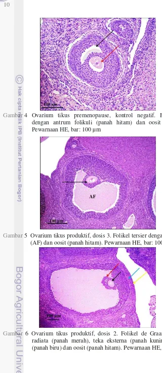 Gambar 4  Ovarium tikus premenopause, kontrol negatif. Folikel sekunder 