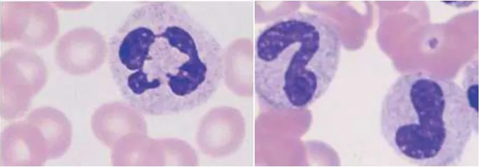 Gambar 4. Neutrofil segmen dan neutrofil batang. Dikutip dari Theml.35 