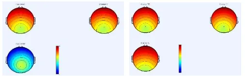 Fig 10. Comparison of brain mapping Subject 1 Channels O1,O2, and PZ. 