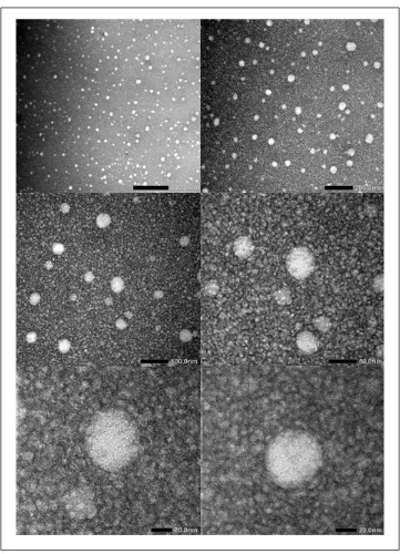 Gambar 3. Morfologi globul nanoemulsi astaxanthin (perbesaran 20 nm hingga 500 nm).