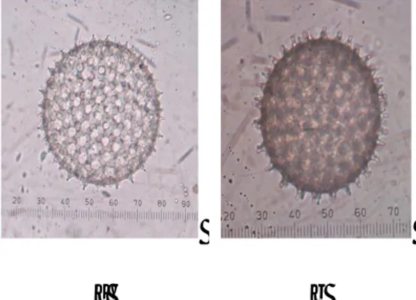 Gambar 1.  Bentuk polen I. trifida.   (a)  Oblate  spheroidal;  (b)  Prolate  Spheroidal 