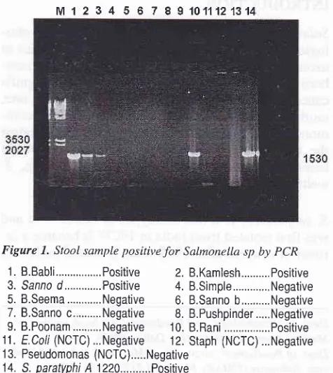 Table 1.negative bacteria such as E. coli, Klebsiella, Pseudo-