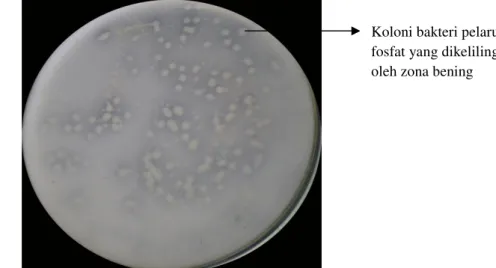 Gambar 3.  Hasil isolasi bakteri pelarut fosfat dari rizosfer 