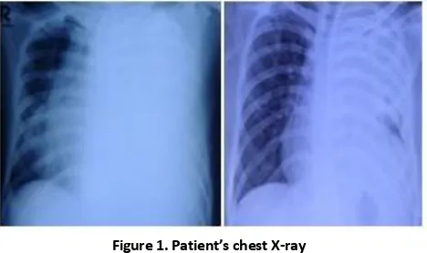 Figure 1. Patient’s chest X-ray 