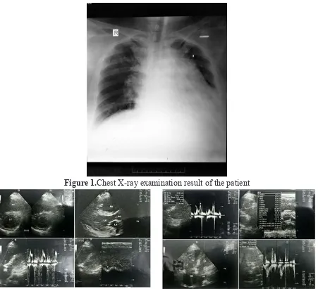 Figure 1. Chest X-ray examination result of the patient 