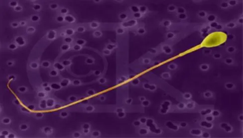 Gambar Sel Spermatozoa (Junqueira, 1995)  