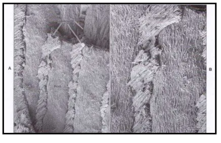 Gambar 3. A dan B tampilan  Scanning Electron Microscope   kristal pada enamel rod dan interrod15 