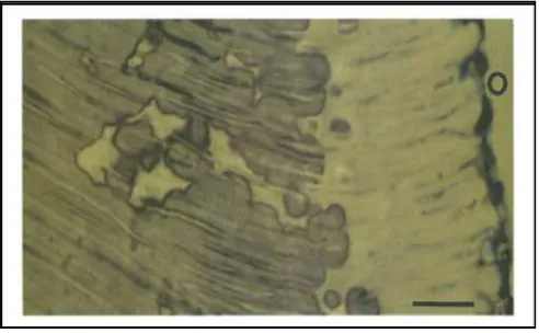 Gambar 8. Gambaran mineralisasi predentin yang terganggu.                   Calcospherites gagal berfusi sehingga meninggalkan                   daerah dentin interglobular yang tidak termineralisasi 