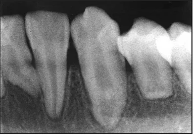 GAMBARAN RADIOGRAFI 