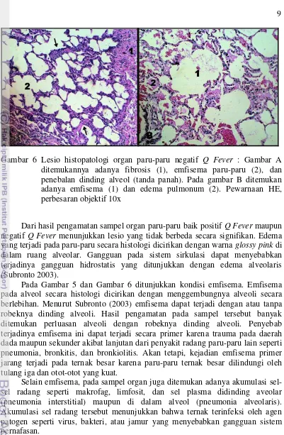 Gambar 6 Lesio histopatologi organ paru-paru negatif Q Fever : Gambar A 