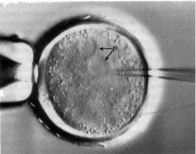 Gambar 2.11.  Menghasilkan domba transgenik melalui mikroinjeksi trasgen yang  diklon ke dalam satu di antara dua calon inti (pronuklei) dari sel telur  terbuahi