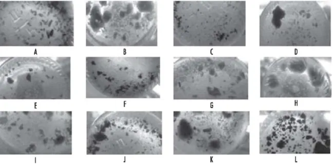 Gambar 2. Struktur embrio somatik (a. globular, b. hati, c. torpedo) yang diperoleh setelah inkubasi suspensi selmanggis dalam medium ½ MS0 selama 8 minggu