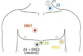 Figure 1. Electrodes position on the thorax and the base of neck. Z1 (white) and Z2 (blue) are electrodes for measuring heart rate