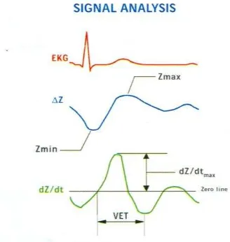 Figure 2. Schematic of signal analysis displayed on computer monitor. Red line represents ECG waveform