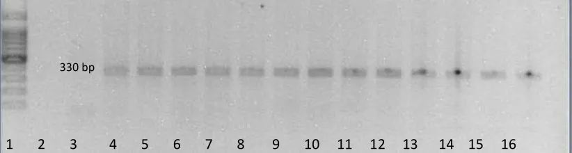 Gambar V.2. Visualisasi produk PCR yang dijalankan pada gel agarose 0,8% elektroforesis