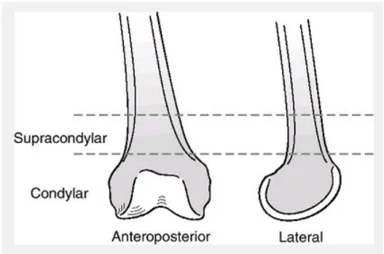 Gambar 1. Anatomi Femur