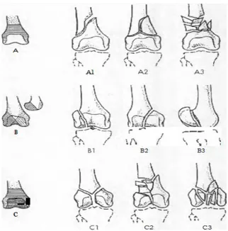 Gambar 7. Klasifikasi AO (Muller and colleagues) 7. Diagnosis