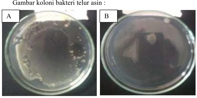 Gambar koloni bakteri telur asin : 