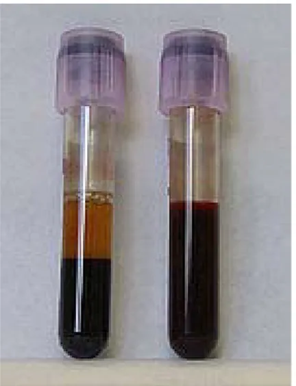 Gambar 2. Sampel Darah Manusia (http://id.wikipedia.org/wiki/Darah) 