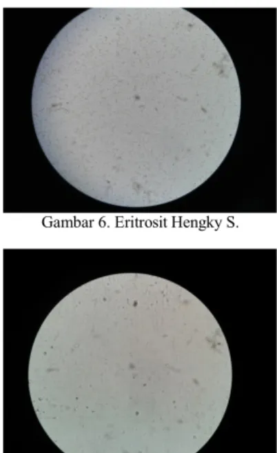 Gambar 6. Eritrosit Hengky S.