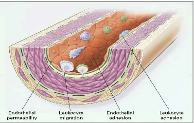 Gambar 1 : Disfungsi endotel  Adesi dan migrasi lekosit kedalam dinding arteri  Sumber : Ross Russel