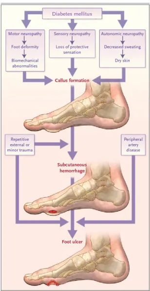 Gambar 3 Patofisiologi Diabetic Foot 