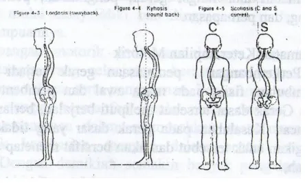 Gambar 2. Intrumen pengamatan bentuk ruas tulang belakang  
