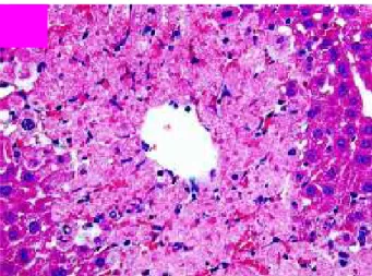 Gambar 7. Gambaran histopatologis hepar akibat keracunan asetaminofen   menunjukkan adanya gambaran nekrosis di sentrilobuler