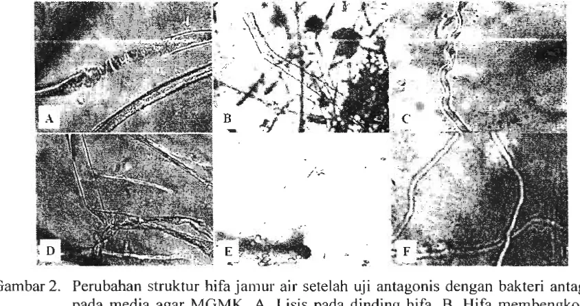 Gambar 2. Perubahan struktur hifa jamur air setelah uji antagonis dengan bakteri antagonis 