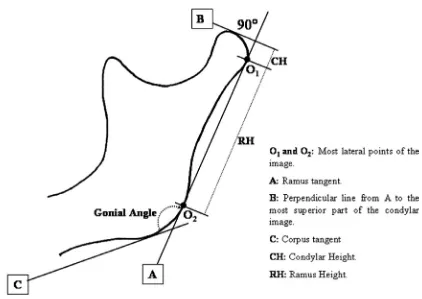 Gambar 2.7Metode pengukuran sudut gonial berdasarkan Raminez-Yanez, 2.9 Kerangka Teori sudut gonial mandibula yaitu sudut yang dibentuk oleh garis singgung posterior ramus-kondilus dengan garsis singgung inferior korpus.4 