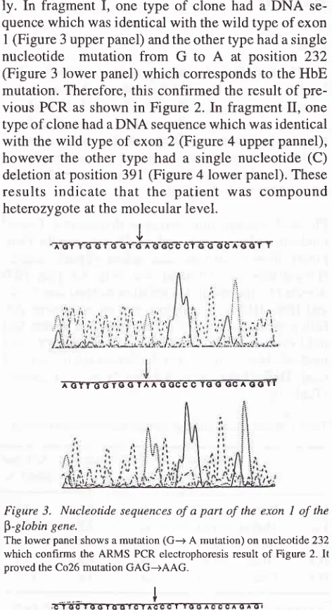 Figure l. The sequences of the primers used for detecting HbE