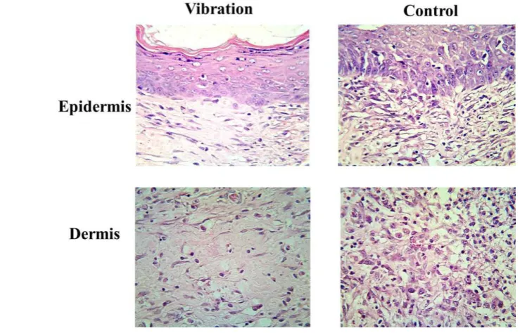 Figure 1. The visual difference of wound in the vibration and control group  (bar = 1 cm) 