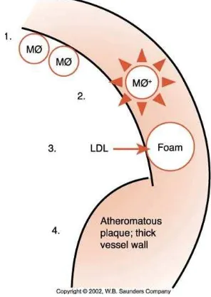 Gambar 3. Patogénesis aterosklerosis (Mealey, et al. 2006). 1. Monosit/makrofag menempel pada endotel 