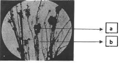 Gambar 5. Penampakan Aspergillus sp. di bawah mikioskop (perbesaran 40 kali) (a.Spora; b